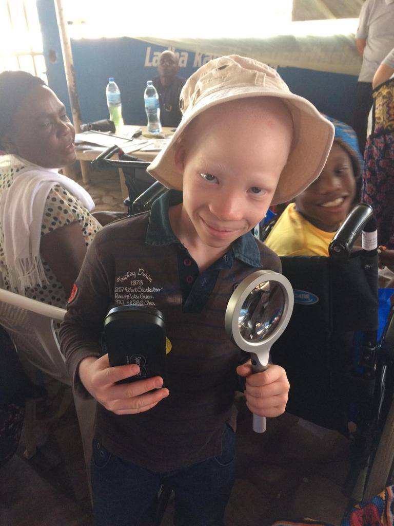 A young boy with Albinism wearing his sunhat and holding his magnifying glass